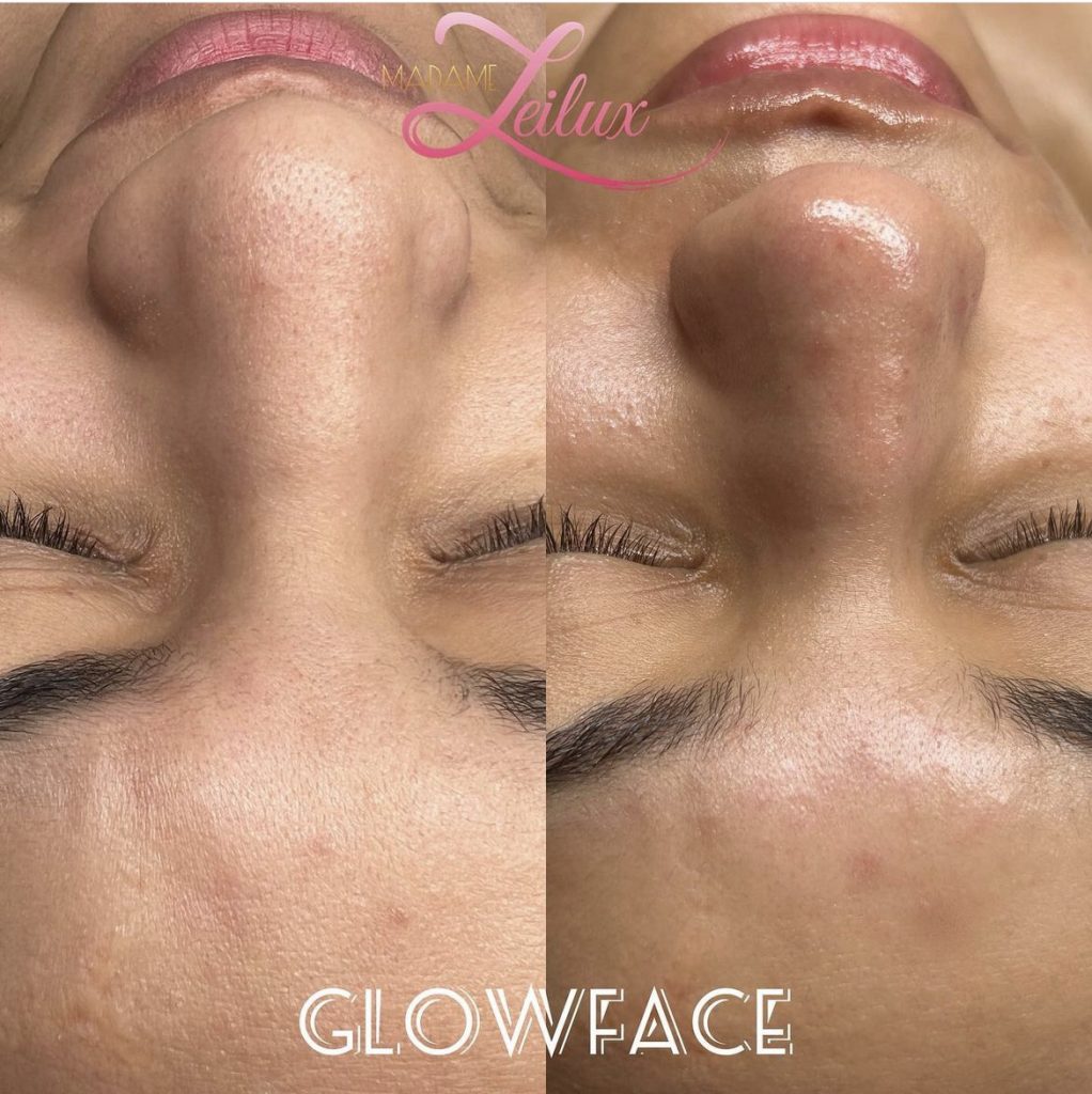 Glowface